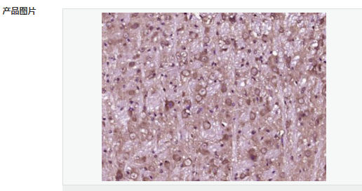 605856eb38394.png image.png