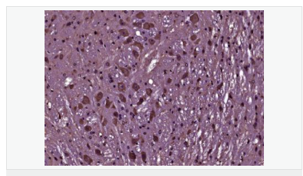 6066ae4094974.png image.png